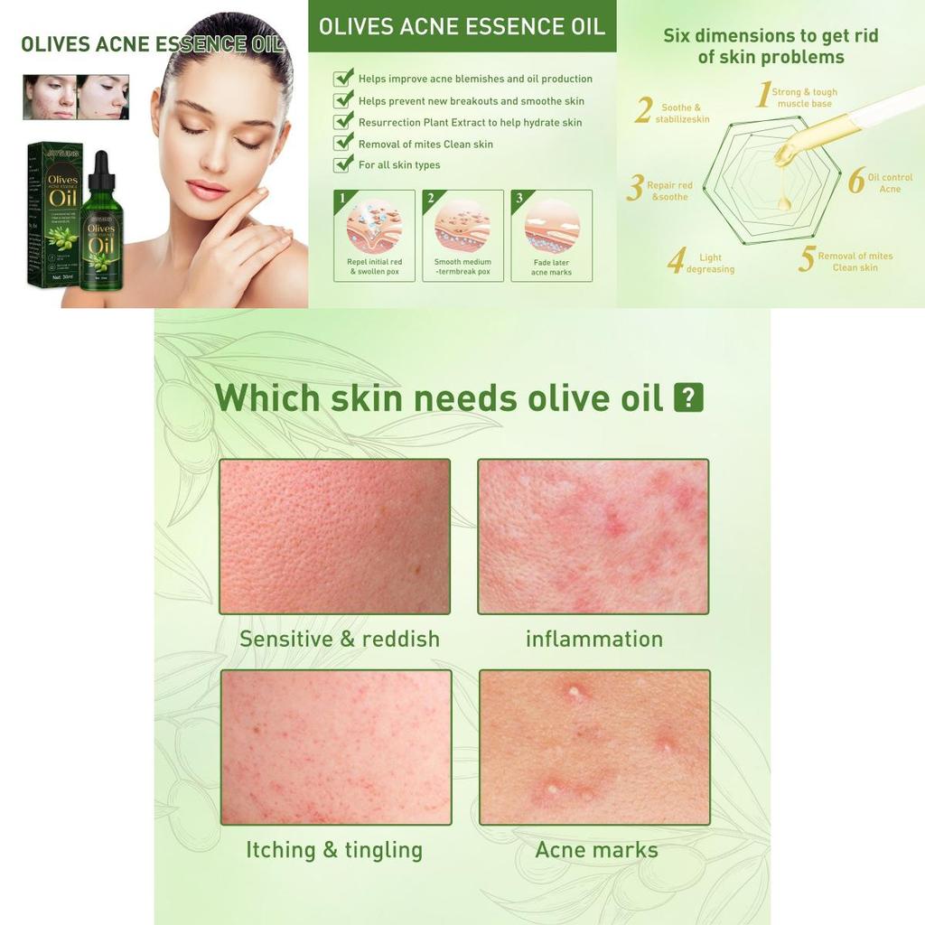 Jaysuing Essential Oil For Gentle Moisturizing And Acne Scar Repair 30ml