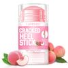 Rissige Fersen Balsam Fuß Stick mit Aloe und Vitamin E für Tiefenfeuchtigkeit bei trockenen Füßen