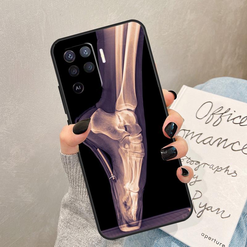 X-Ray Human Anatomy Case For Oppo A40 A60 A80 A78 A38 A18 A98 A58 A96 A76 A16 A94 A74 A54 A15 A17 A57 A77 A5 Pro