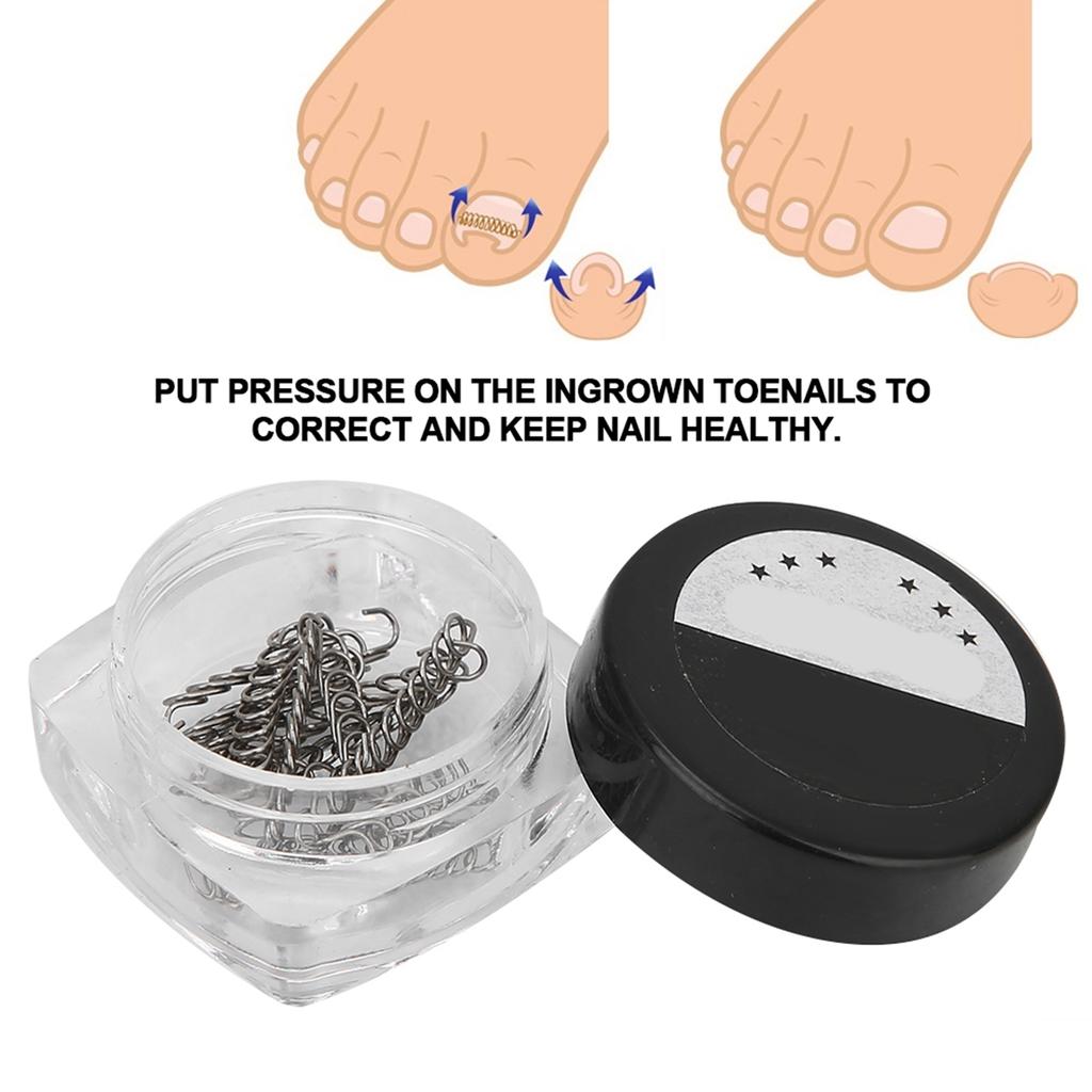 2Box Ingrown Fixer Wire Toenail Correction Nail Ingrowing Corrector Pedicure Care Tool