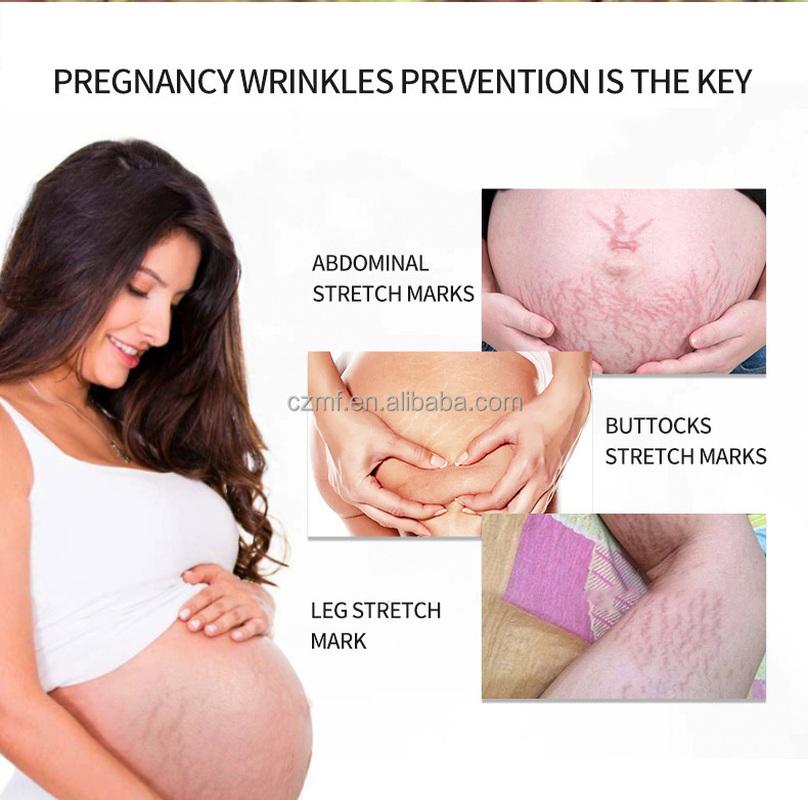 Natural Organic Postpartum Stretch Mark Removal Skin Repair Cream Body Pregnancy Scar  Cream For Women