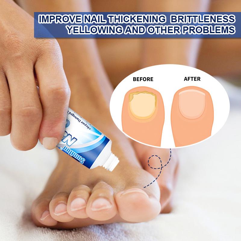 Nail Cream, Cleans and Smoothes Nails, Repairs Damaged Nails, Strengthens Nails, Promotes Nail Health, Nourishes and Essence