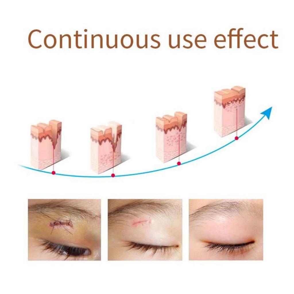 Scar removing essence repairing skin whitening brightening essential oil moisturizing and hydrating fluid