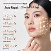 AMIRO LED Light Therapy Face Mask CN plug (adapter included)