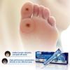 20G Foot Corn Removal Killer Foot Protection Pain Relief Curative Cream Medical Corns Plaster