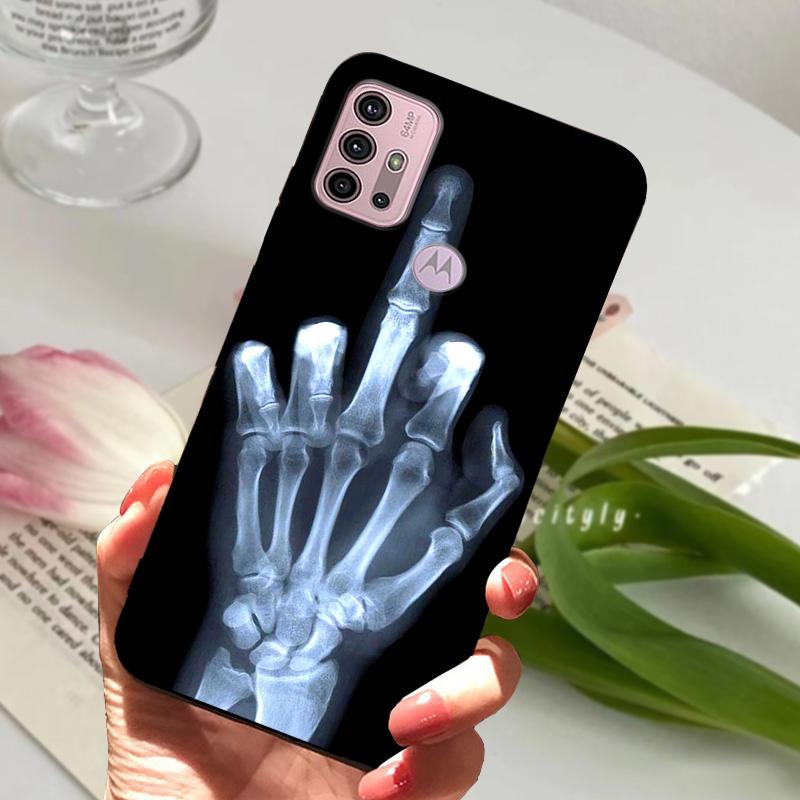 For Moto G10 Case Soft TPU Silicone Phone Cases For Motorola G13 G23 Protective Cover For Moto G100 Shockproof Bumper Fundas