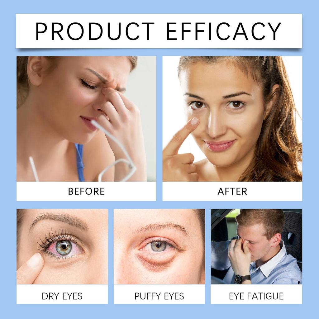 WIIEEY Sleep Steam Eye Mask Gentle Hot Compress Relieves Eyestrain Enhances Sleep QualityDaily Use