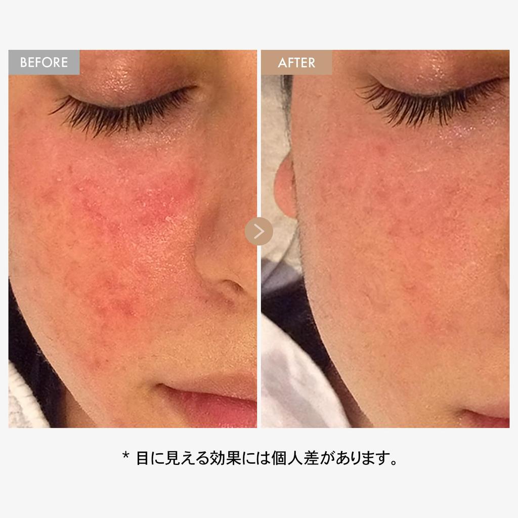 TOSOWOONG Real Oatmeal Relief with Colloidal and Hyaluronic Moisturizing and This Face Cream Is Perfect for Sensitive and Dry Made by a Korean