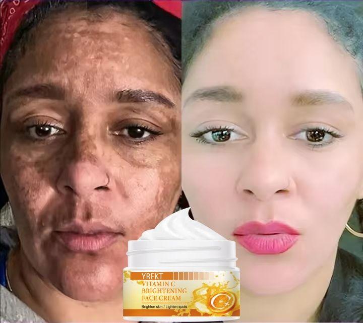 Vitamin C face cream moisturizes the face, desalinates acne marks and spots, and brightens, moisturizes and repairs the skin