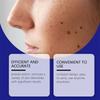 Newly Upgraded Blue Laser Pen for Skin Care, Gently Caring for Every Inch of Your Skin
