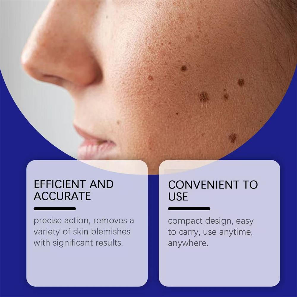 Newly Upgraded Blue Laser Pen for Skin Care, Gently Caring for Every Inch of Your Skin