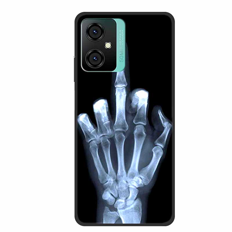 Etui do Blackview Oscal C70 Etui na telefon z kreskówkowym zwierzątkiem Luksusowe Silikonowe TPU Do Blackview C70 C 70 Miękkie Etui Ochronne Coque