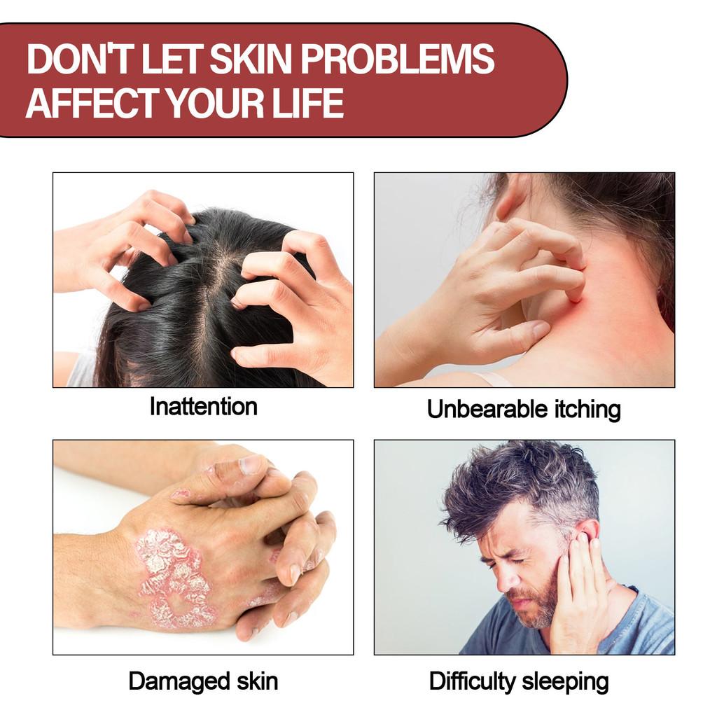 Ximonth Skin Repair Spray Soothing Hydrating Relief For Itchy Red Skin Moisturizer