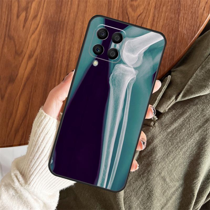 X-Ray Human Anatomy Case For Samsung Galaxy M11 M21 M31 M35 M12 M13 M14 M15 M16 M36 M56 M53 M32 M52 M55 M34 M54