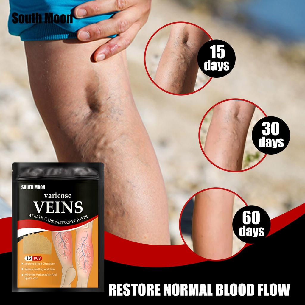 VeinCurea Varicose-Veins  Patch