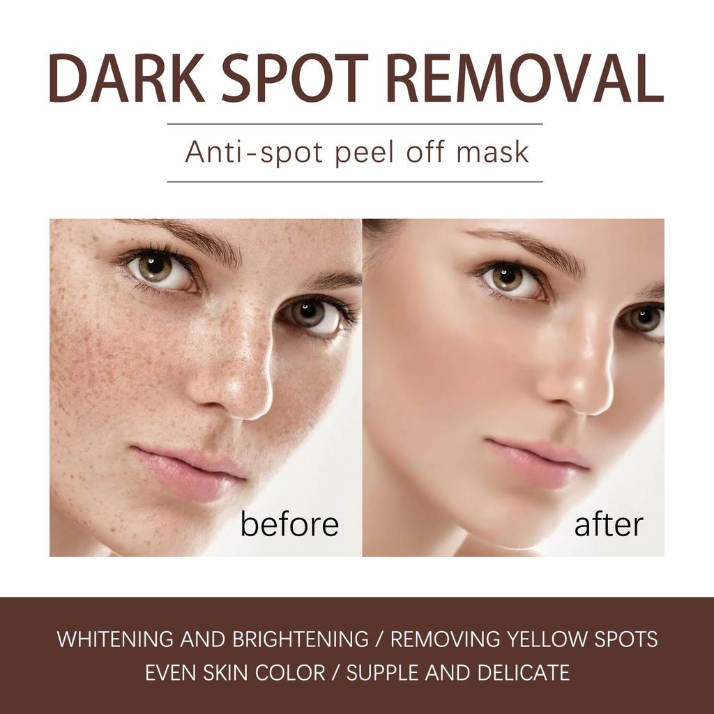 Spots Peel off Facial Mask Freckle Pigmentation Removal Cream Chloasma Care Dark Spot Correction Glow Whiten Peeling Mask Strong