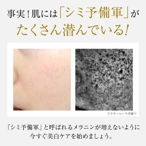 Dr.Ci-Labo(Old Model) Medicinal Aqua Collagen Gel Whitening EX 120g Brightening [Lotion, Essence, Emulsion, Cream, All-in-one Gel] Highly Moisturizing