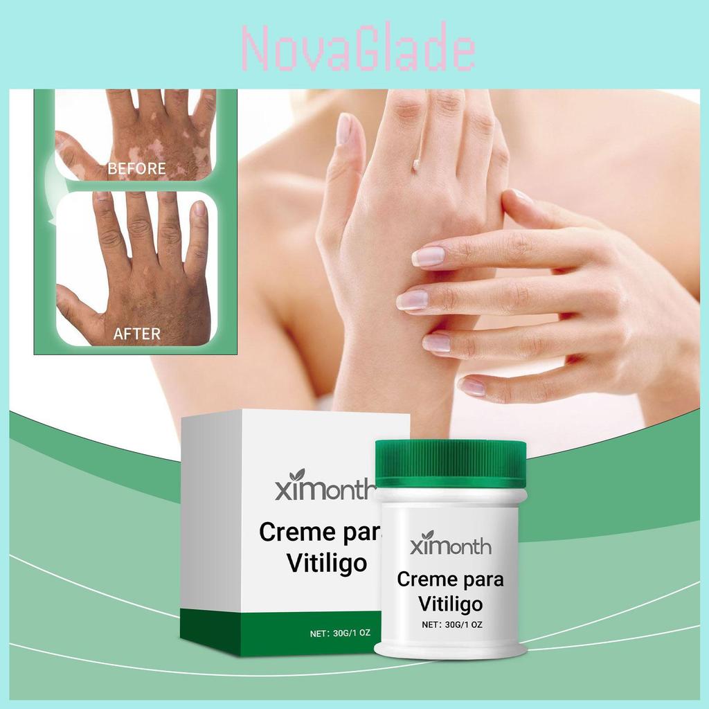 Ximonth Skin Repair Cream For Ultimate Hydration Nourishing Moisturizing Body Care