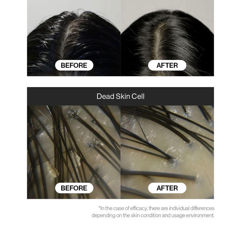 GROWUS - Sea Salt Therapy Scalp Scaler Jumbo