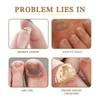 West & Month Nail Care Solution Hand And Foot Nail Cleaning Nail Care Solution