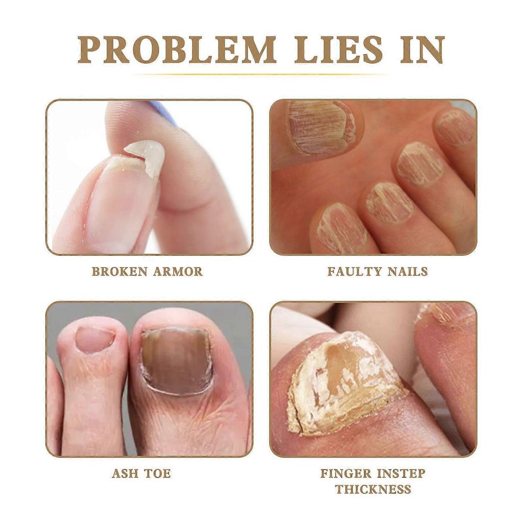 West & Month Nail Care Solution Hand And Foot Nail Cleaning Nail Care Solution