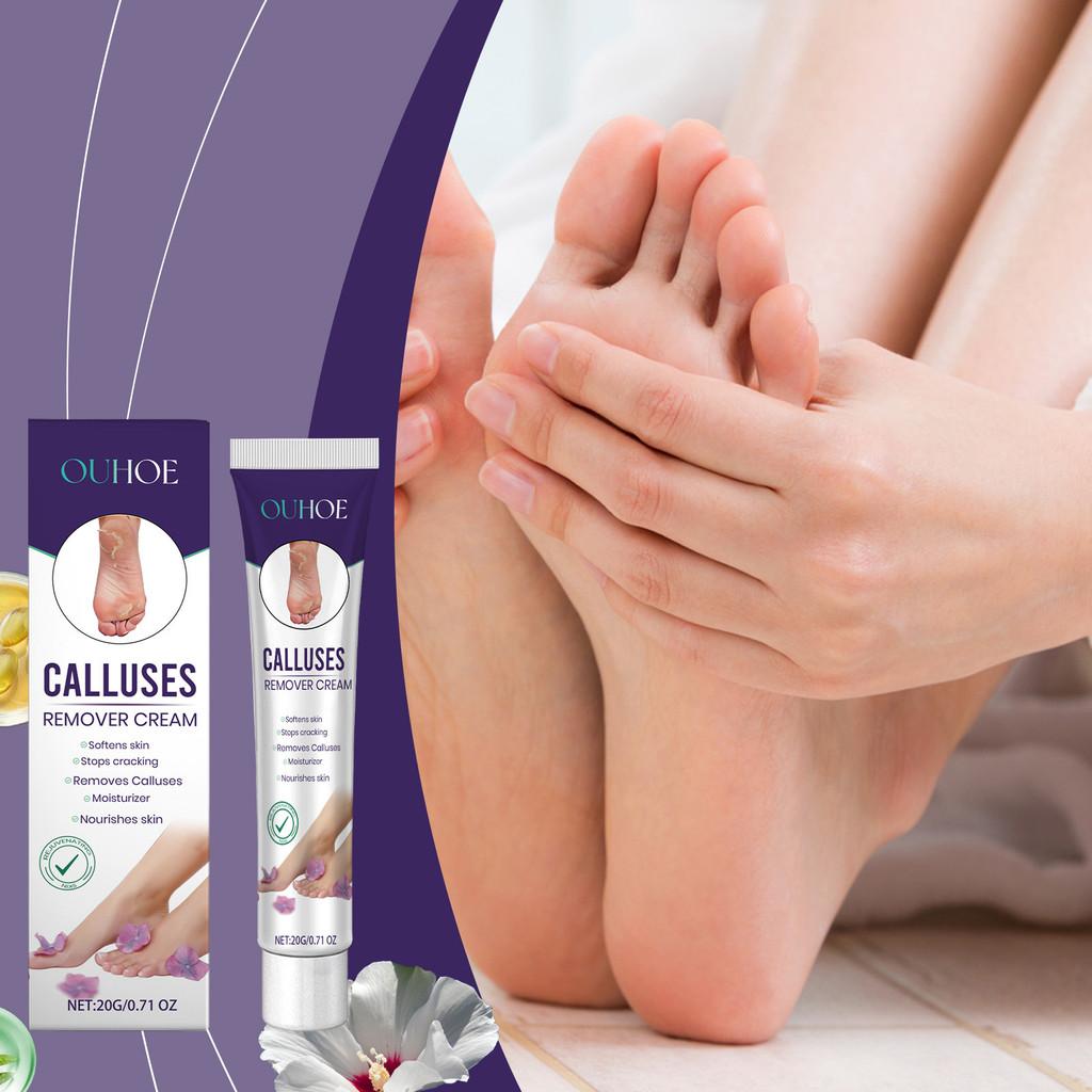 Ouhoe Foot Peel Repair Cream Gentle Moisturizing Softening For Dry And Cracked Skin
