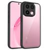 For OPPO Realme 16 Pro Plus Case Hard PC Slim Transparent Shockproof Protective Back cover Case For Realme 16Pro Plus + Shell