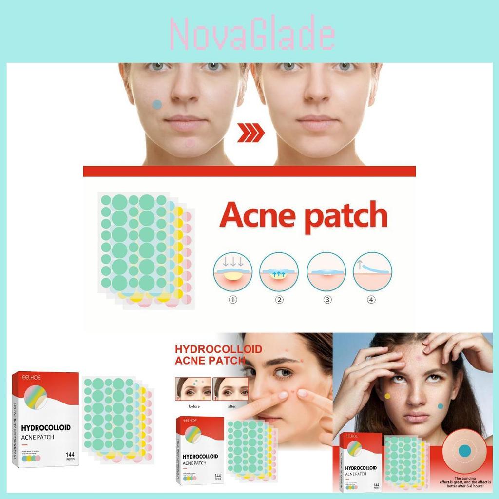 Eelhoe Colorful Acne Patches Gentle Non-irritating Hydrocolloid Treatment For Blemishes And Pimples 144pcs