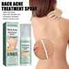 Cuidados de rosto – Remédios para acne