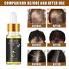 Hair Care Essential Oil Hair Nutrient Solution Growth Strong Hair Soft Essence Anti-loss Dense Hair Care Essential Oil
