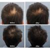 NanoImpact - NanoImpact 8 Hair Growth Agent