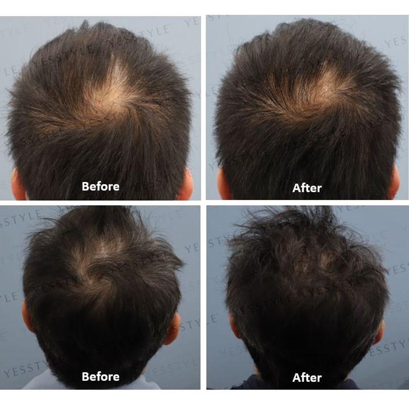 NanoImpact - NanoImpact 8 Hair Growth Agent