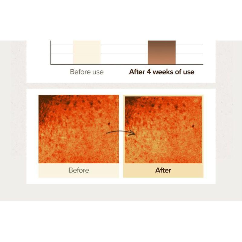 SKINFOOD - Potato Madecassoside Mask Bundle Set