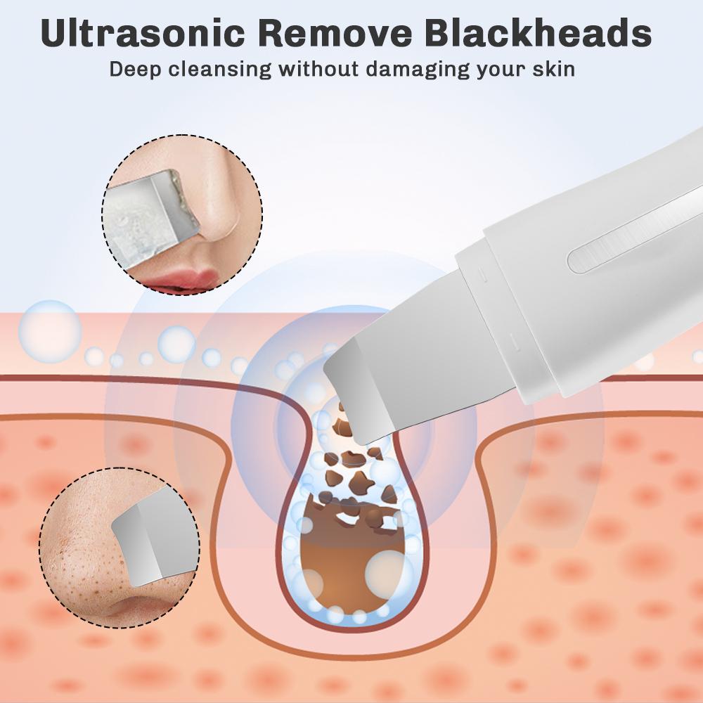 Ultrasonic Skin Scrubber Face Spatula Facial Skin Exfoliator Scraper and Blackhead Remover Pore Cleaner Facial Deep Cleansing