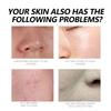 West Month Black Spot Repair Cream Hydrating Moisturizing Foundation For Flawless Skin