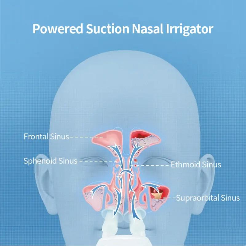 Electric Nasal Care Nose Cleaner Portable Rhinitis Sinus Nasal Irrigation Bottle Adjustable Pressure Rinse Nasal Irrigador