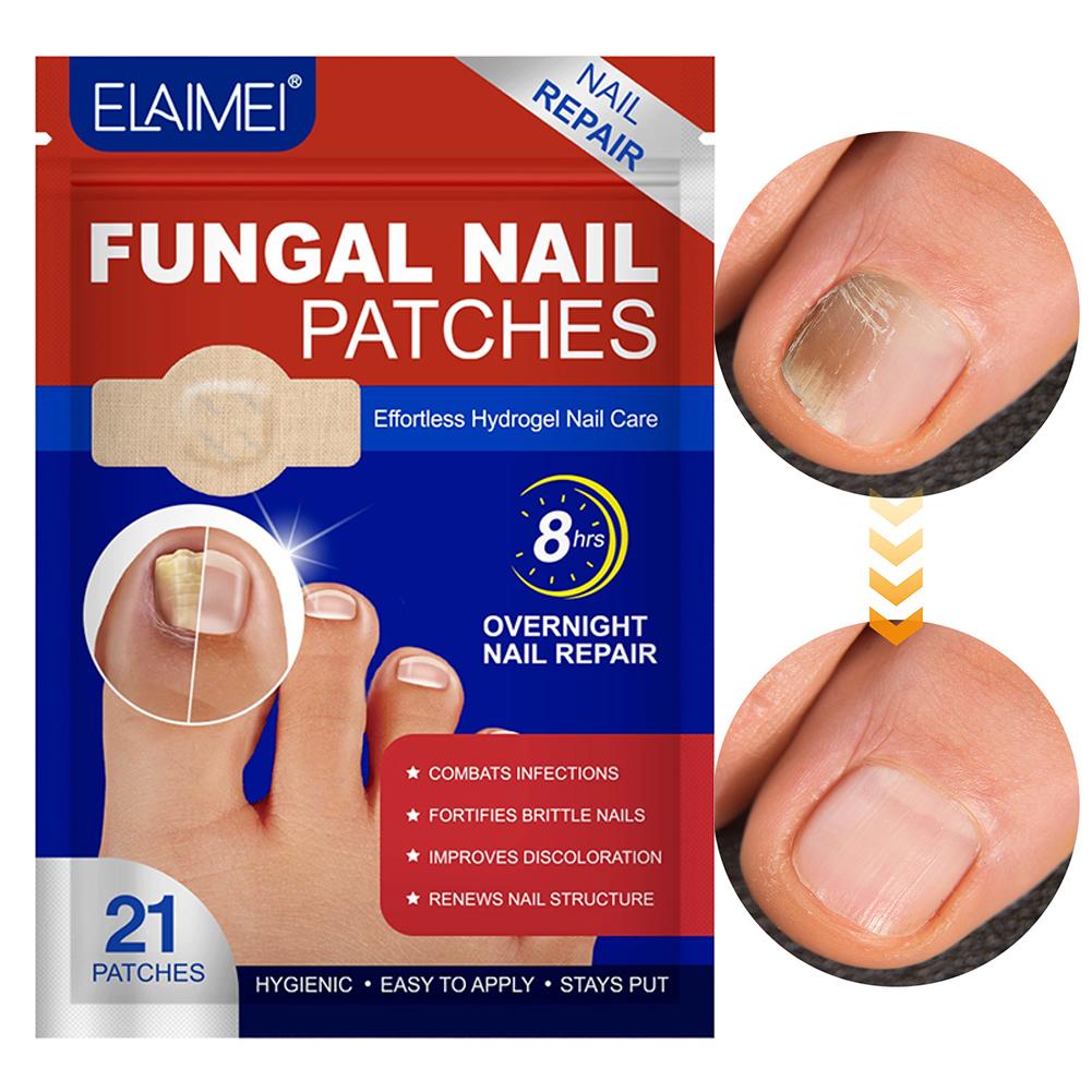 Szary plaster na paznokieć u stopy Plaster do naprawy paznokci grzybiczych Plaster korygujący wrastające paznokcie Pielęgnacja paznokci u stóp Plaster do leczenia zanokcicy 1/5 opakowań
