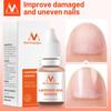MeiYanQiong Tratament de reparare a unghiilor Ulei esențial pentru unghii de lavandă Nail Art & Tools Tratament sănătos pentru unghii Îngrijirea picioarelor