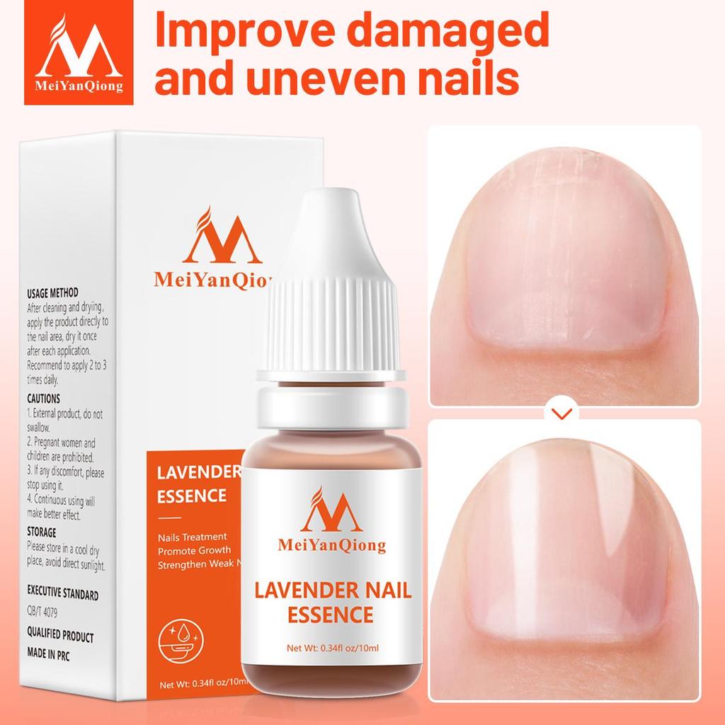 MeiYanQiong Tratament de reparare a unghiilor Ulei esențial pentru unghii de lavandă Nail Art & Tools Tratament sănătos pentru unghii Îngrijirea picioarelor