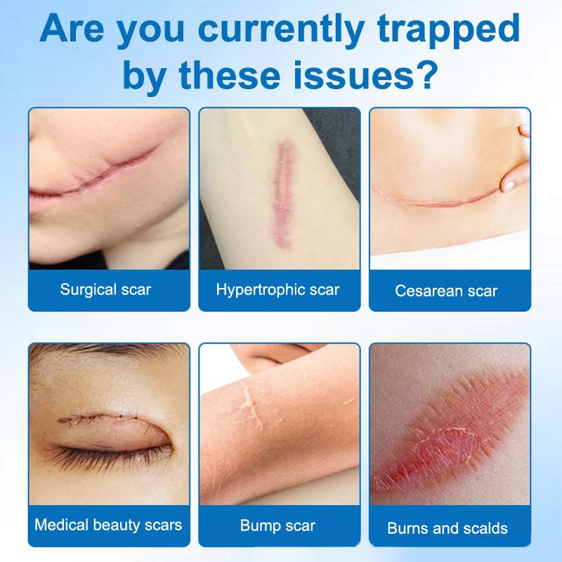 Silikon Su Geçirmez Kusur Gizleme Etiketleri Ultra İnce Doğal Görünüm Leke Tam Kapatma Görünmez Pratik Dövme Kapatıcı Etiket