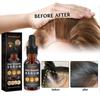 West Month Hair Growth Nutrient Oil For Lush And Thick Hair Nourishing Care 30ml