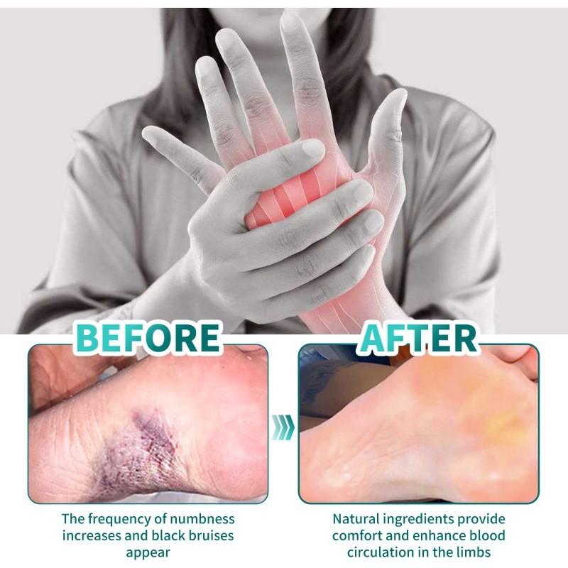 Ximonth Hand And Foot Relief Cream For Numbness And Swelling With Soothing Properties