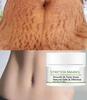 Crema per la rimozione delle smagliature Elimina le cicatrici della gravidanza Riparazione della maternità Anti rughe Rassodante per la pelle