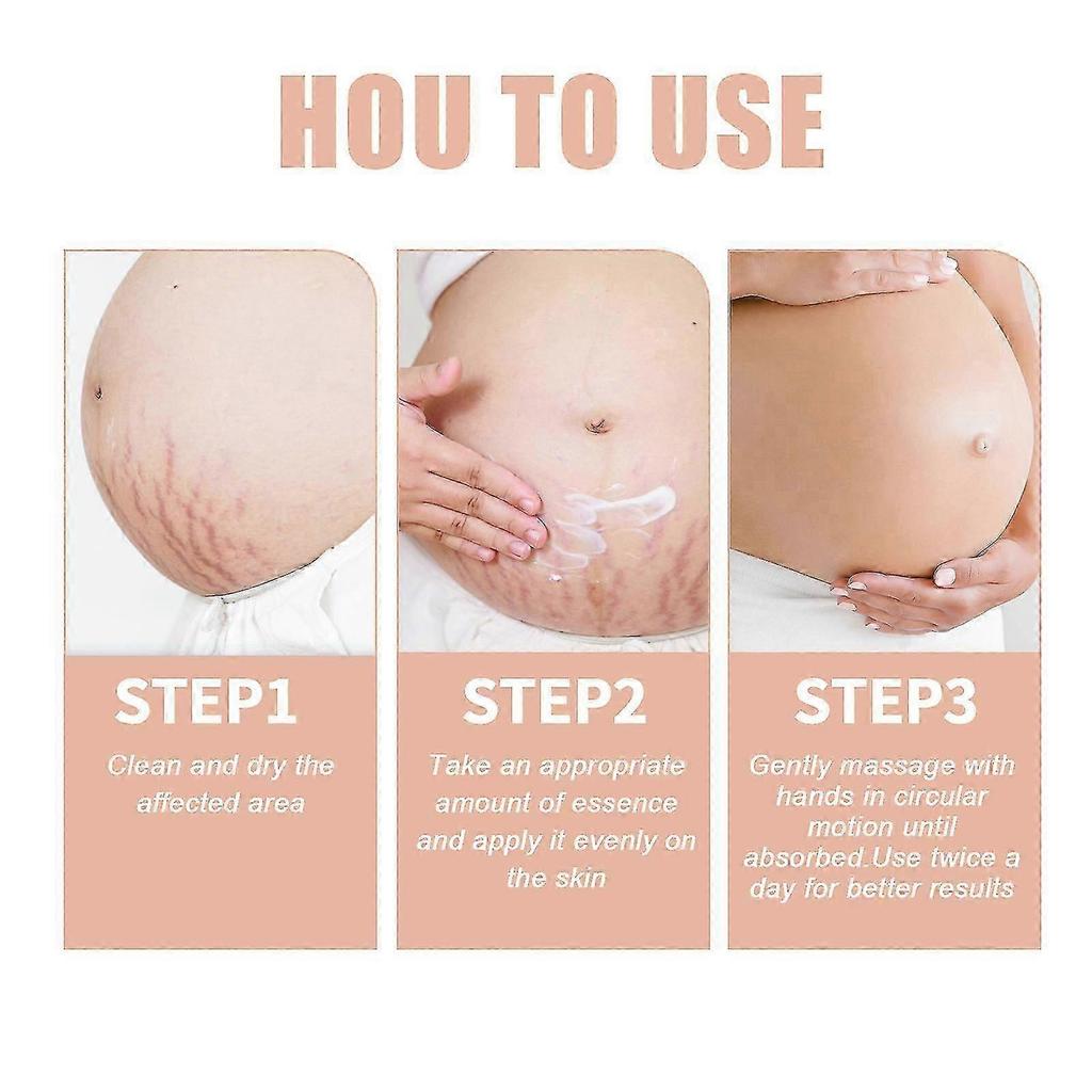 Wiieey Snail Essence Pregnancy Cream Firming Skin Repair Fading Postpartum Pregnancy Marks Pregnancy Obesity Wrinkle Cream Lotion & Moisturizer1pcs) -