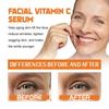 Anti-aging Brightening Vitamin C Essence For Rejuvenating And Hydrating Skin 30ml