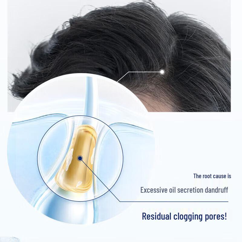 Head & Shoulders Oil Control & Volumizing Anti-Dandruff Shampoo