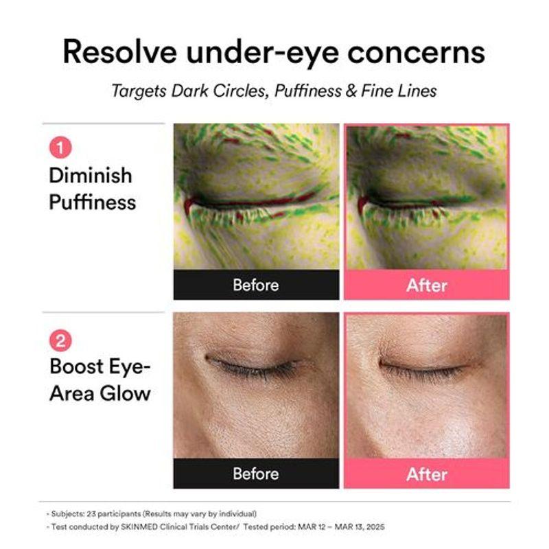 ABIB PDRN Retinal Augenpflaster Glow Jelly 60 Stück