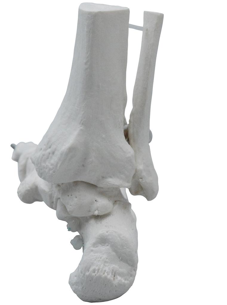 Monolife Foot Bone Model, Foot Bone Model, Ankle Joint Model, Right Foot Specimen, Ankle, Articulating Type