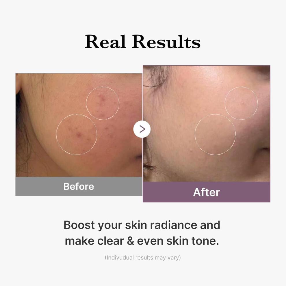 Medicube Age-R Glutathione Glow Toner - Milky 2-Phase Toner with Peptides & Glutathione for Glass Skin Effect - Radiant, Hydrated Complexion - 140 Ml