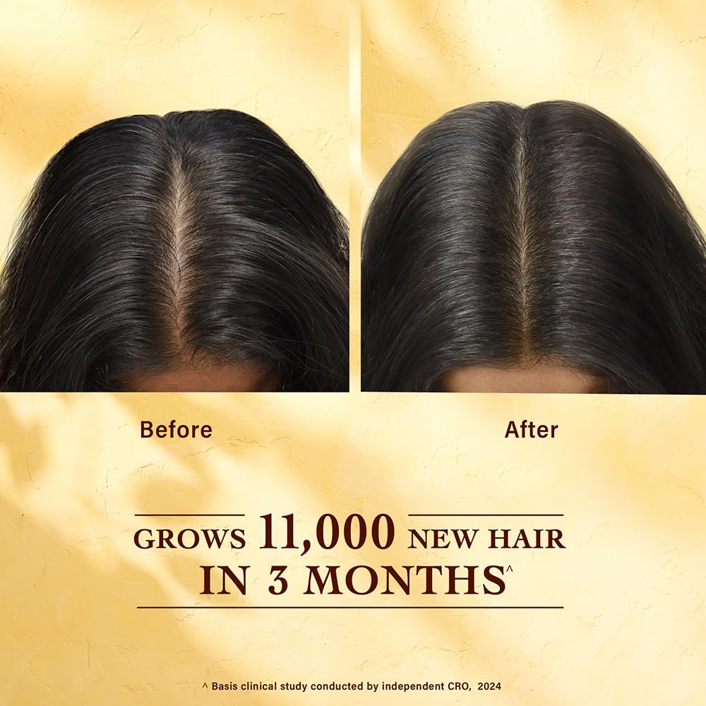Indulekha Bringha Hair Growth Scalp Serum 30ml Pack Of 1 Lightweight Non Greasy Ayurvedic Formula For Stronger Fuller Healthier Hair